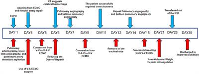 ECMO management for severe pulmonary embolism with concurrent cerebral hemorrhage: a case report